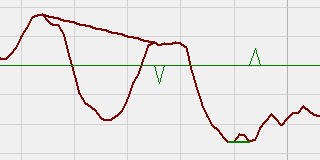 MACD Divergence